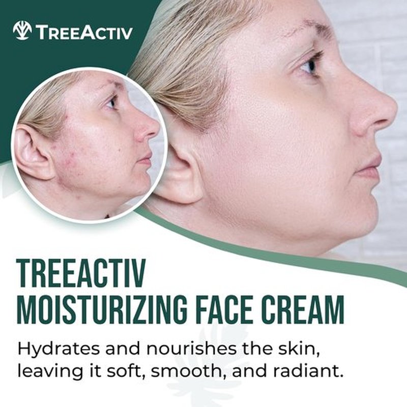 TreeActiv Acne Eliminating Face Cream - Tea Tree Moisturizing Formula for Balanced Skin | 2 fl oz