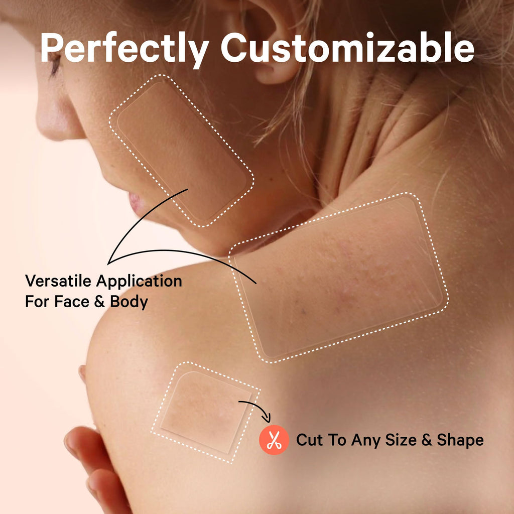 Sosky Large Pimple Patches XL Hydrocolloid Acne Patches for Face & Body Cystic Pimple & Zit Patch for Nose Chin Back, Bacne & Breakouts Vegan Cruelty-Free（10 Count）