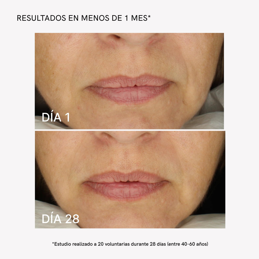 MASDERM - RF Facial Cream 1000 ml, Moisturizing Conductive Cream for Radio Frequency and Microcurrent Devices, Professional and Home Use, Hydrating, Firming, and Smoothing Cream for Face and Neck
