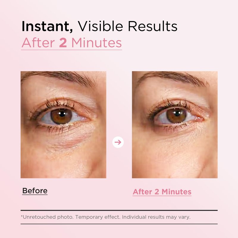 VELAMO ADVANCED Instant Eye & Face Lift Cream: Rapid Under Eye Bags Wrinkles Smile Lines Forehead Lines Remover - Temporary Firming & Tightening Treatment in 2 Minutes 1 OZ/30g
