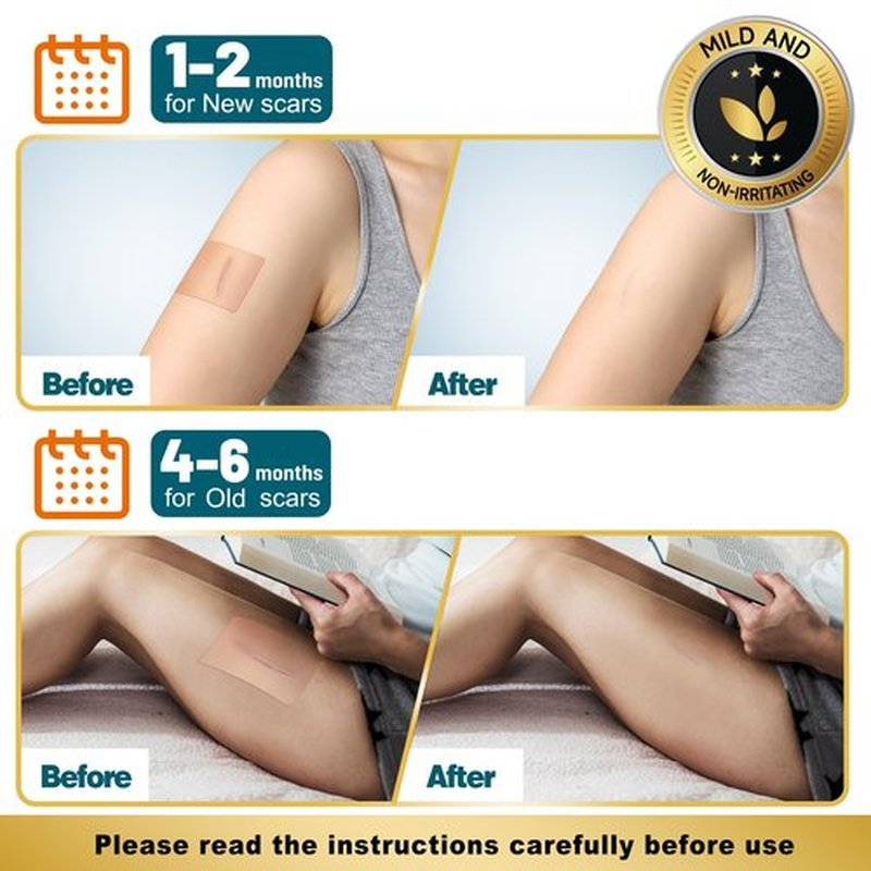 Arme Silicone Scar Tape, 1.6" x 240" Silicone Scar Sheets(2 Rolls-6M), Medical Grade Scar Tape Removal Sheets for Surgical Scars, Reusable Scar Removal Strips for Tummy Tuck C-Section Keloid
