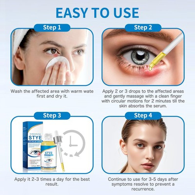 Stye Eye Treatment, Natural Stye Relief Serum for Styes, Chalazions and Blepharitis, Quickly Relieves Eye Irritation and Restores Healthier Skin,30ML