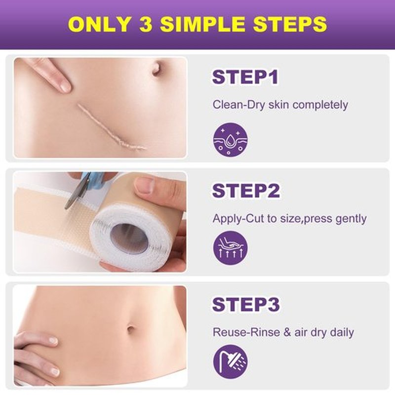 Silicone Scar Sheets, Silicone Scar Tape, Scar Tape for Keloid Bump Removal, Reusable Silicone Scar Strip for C-Section, Keloid, Surgery, Burns, Acne Scar et(1.6”x120”Roll-3M)