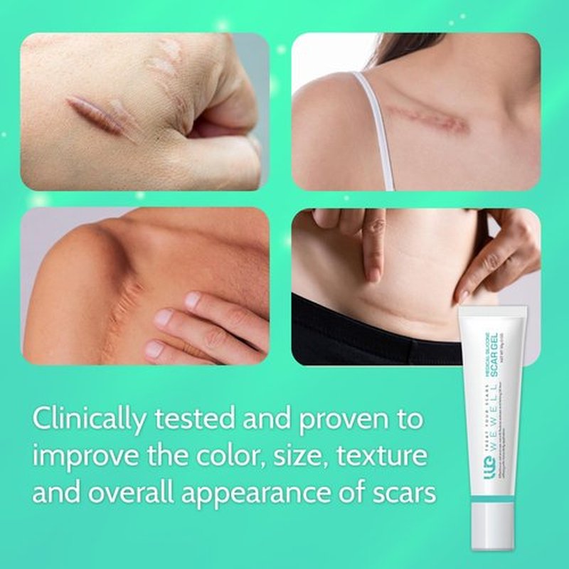 Scar Cream for Keloid Bump Removal: Professional Silicone Gel for Keloids, Acne Scars, Stretch Marks, C-Section & Burn Marks – Old & New Scar Care Treatment, 1 oz