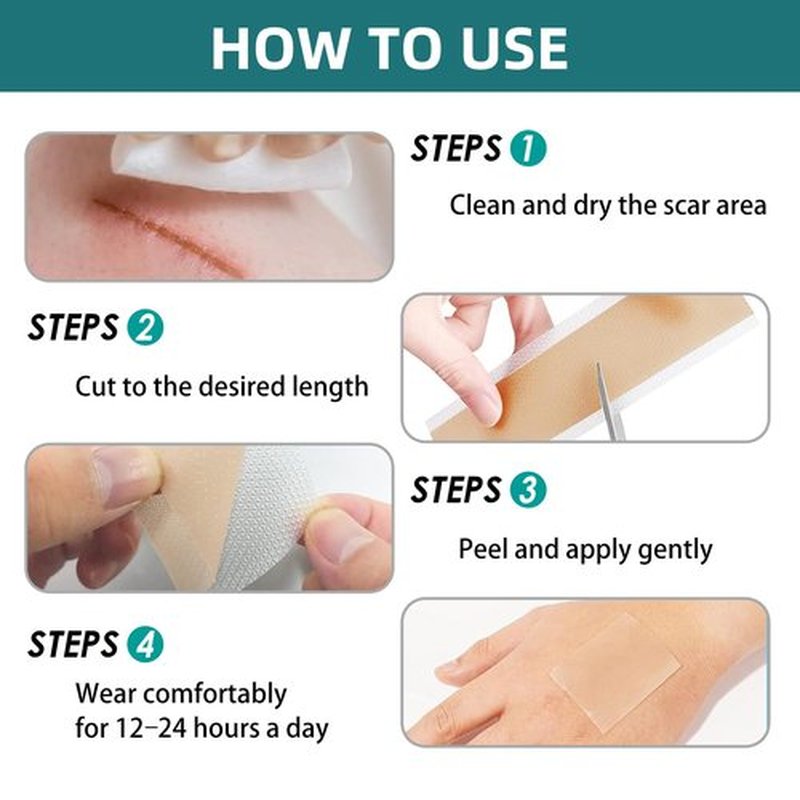 Silicone Scar Gel Sheets: Medical Grade Scar Tape for C Section Surgical Tummy Tuck Keloid Treatment–Scar Removal for Face and Skin