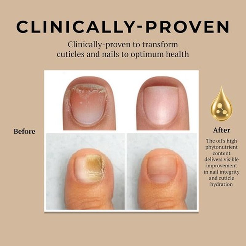 Miracle Fruit Oil Nail Strengthener | 10ml Cuticle Oil for Thin Nails & Growth - Intense Moisture & Protection