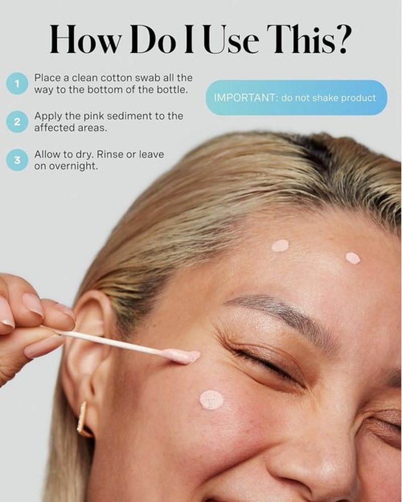 Kate Somerville EradiKate Acne Treatment - 10% Sulfur & BHA Medicated Spot Cream for Clear Skin | 1 Fl Oz