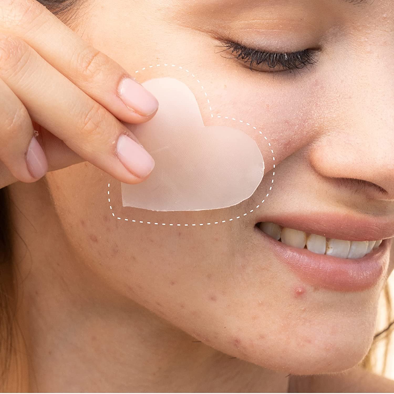 HANHOO Blemish and Custom Patch Duo | Hydrocolloid Patches for Surface Spots and Clusters | 72 Total Patches + 2 Custom Sheets