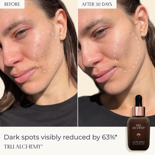 Tru Alchemy Vitamin C Glow Serum - Hydrating Anti-Aging Face Serum with Bakuchiol & Glycolic Acid, 1 fl oz
