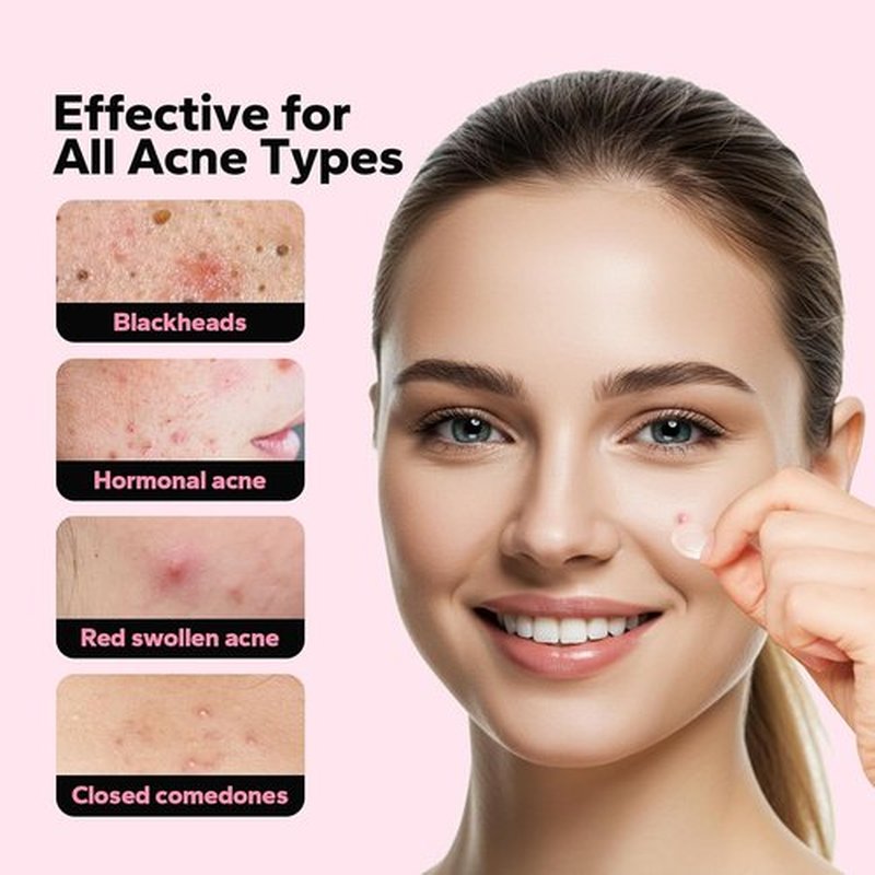 Skiennix Pimple Patches - Microdart Acne Treatment with Salicylic Acid | 18 Count for Fast Relief from Breakouts