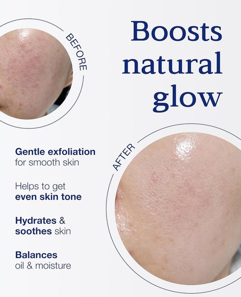 Nuborn Cell Oasis Pad - Hydrating Korean Skin Care Toner Pads with Stem Cell Serum & PHA | 160ml, 70 Soft Pads