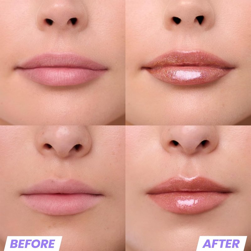 Wonderskin Lip Gloss - Gold Glitter Blading Top Gloss for Hydrating, High Shine Finish