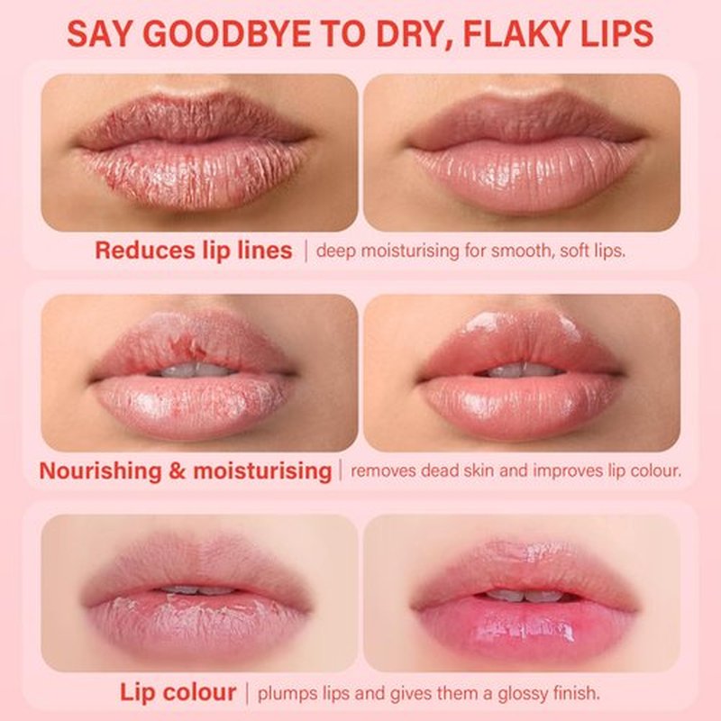 Skiennix Lip Mask Set - 4 Pcs Overnight Lip Care Gift for Women & Teens | Hydrating Shea Butter & Hyaluronic Acid
