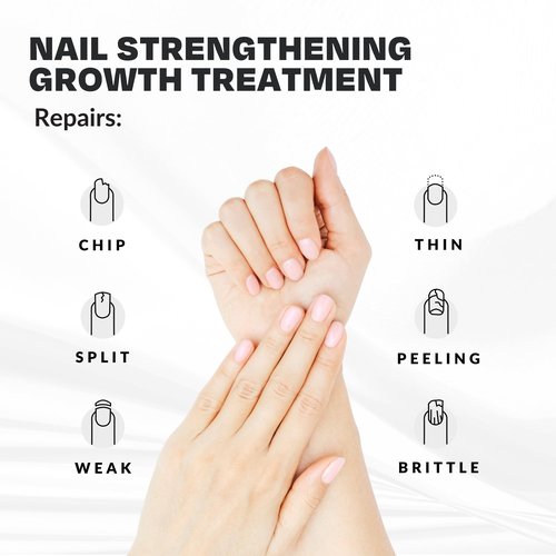 Nail Strengthener Power Boost Growth Formula, Keratin, Biotin, & Vitamin E, 21- Free, Repairs Damaged Nails, Stops Peeling & Chipping, Use as Clear Base Coat & Topcoat .50 fl. Oz. CAKE Nail Treatment