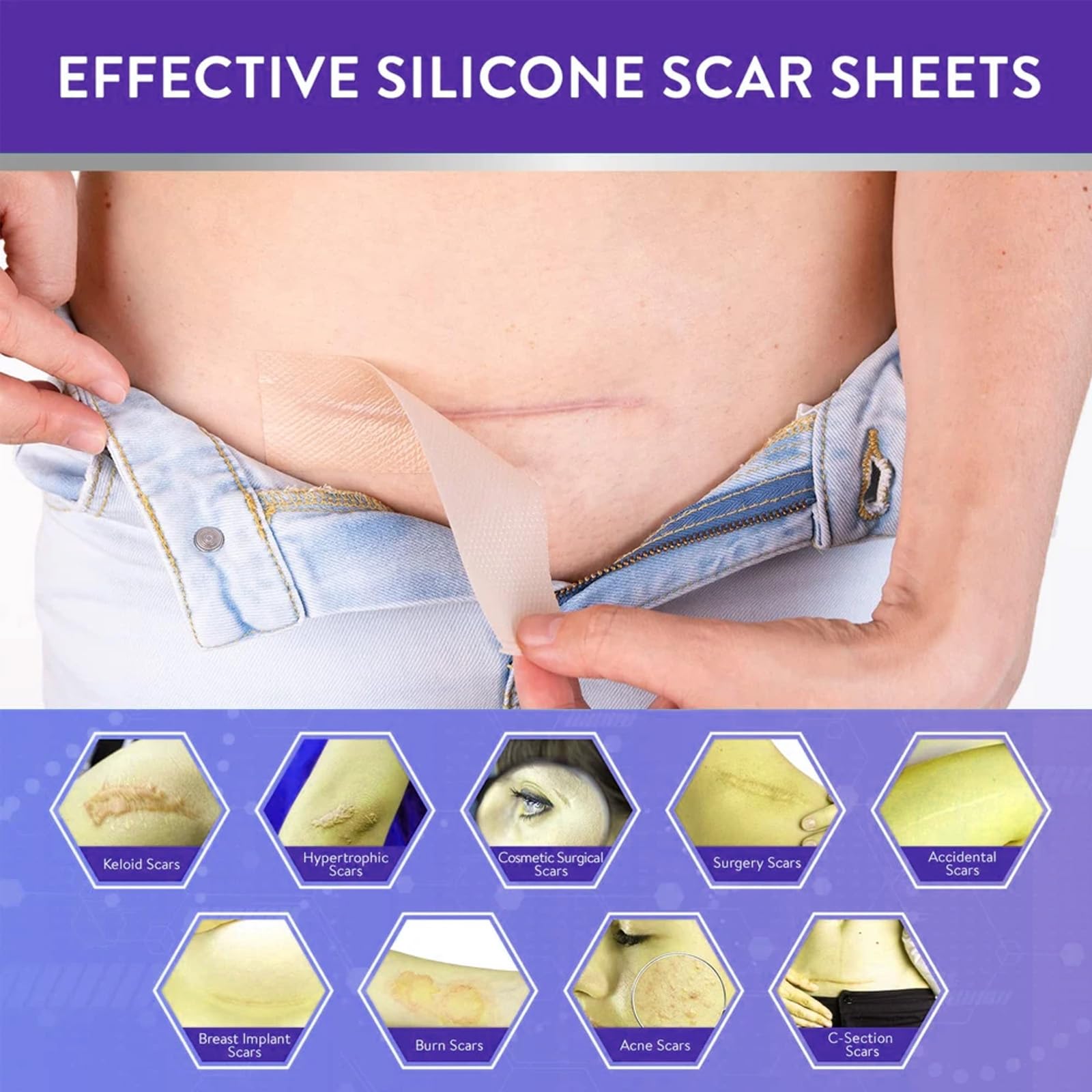 Silicone Scar Sheets,LXIANGN Medical Grade Silicone Scar Tape Professional Scar Removal Sheets Surgical Skin Care (1.5”x 60”Roll)