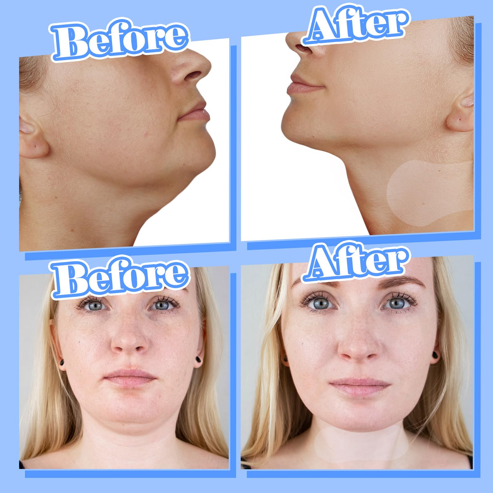 Threlaco 50 Pcs Invisible Neck Lift Tape Pre-assembled Neck Lift Sticker for Sagging Loose Skin for Women, 1.97'' x 4.72''