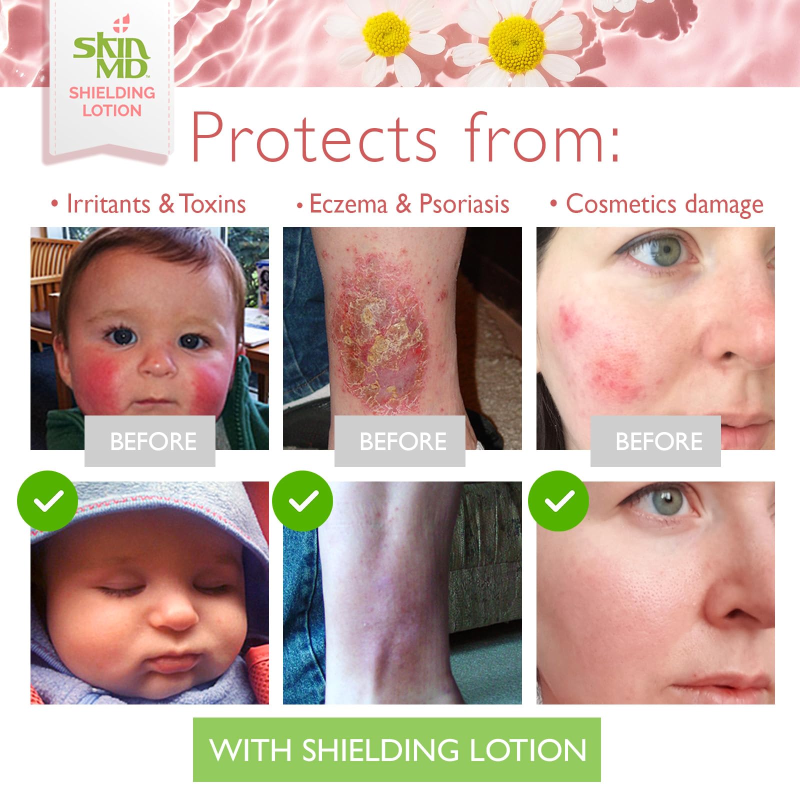 Skin MD Shielding Lotion Hydrating Body Lotion for Sensitive Skin with Dispenser | Non-Greasy, Fast-Absorbing Moisturizer with Plant-Based Ingredients, Eczema & Psoriasis Relief - 8oz Pump