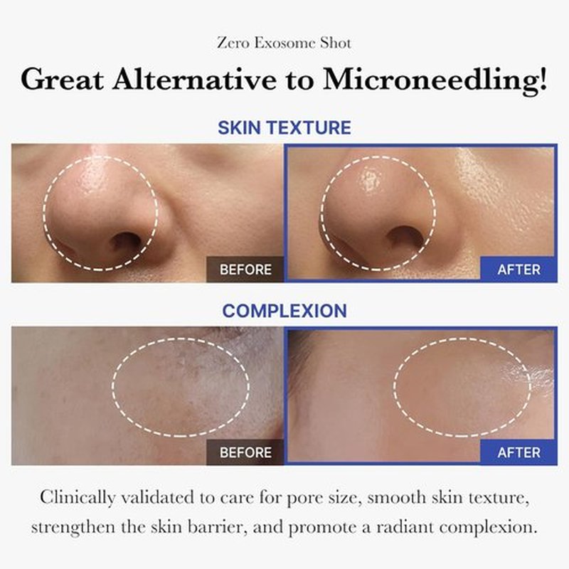 Medicube Flawless Skin Vitamin C Golden Capsule Moisturizer & 7,500 PPM Exosome Serum