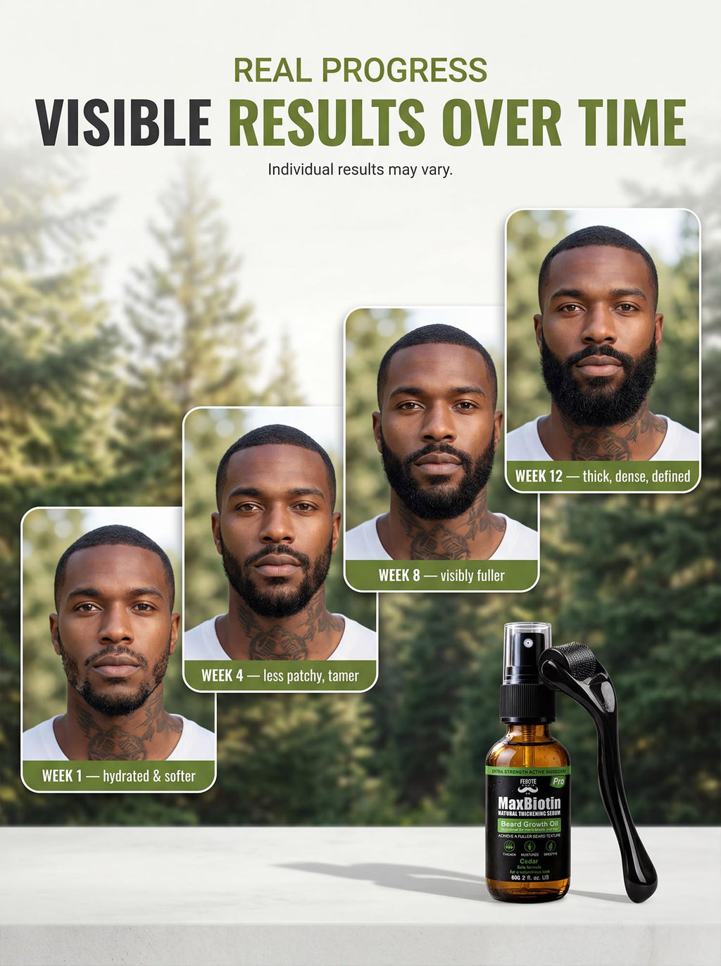FEBOTE Patchy Beard Growth Kit for Men - Thickening Spray with Biotin & Castor Oil + Derma Roller - Cedar Beard Serum for Thicker Fuller Facial Hair - Natural Grooming Gift Set for Him