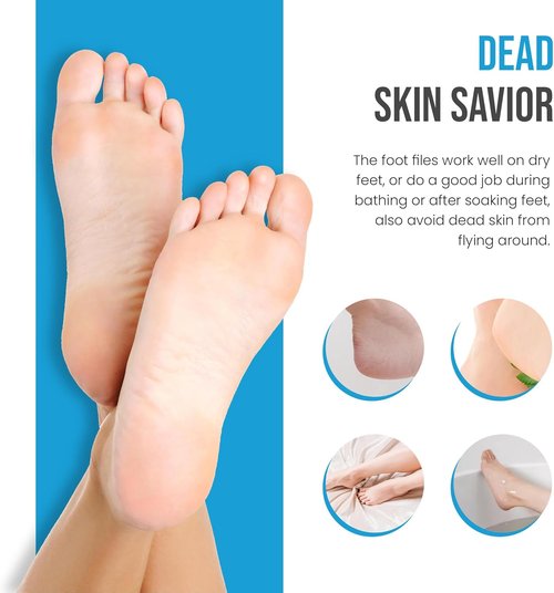 Krisp Beauty Foot Rasp - Professional 7” Callus Remover & Pumice Pedicure Tool for Smooth Feet