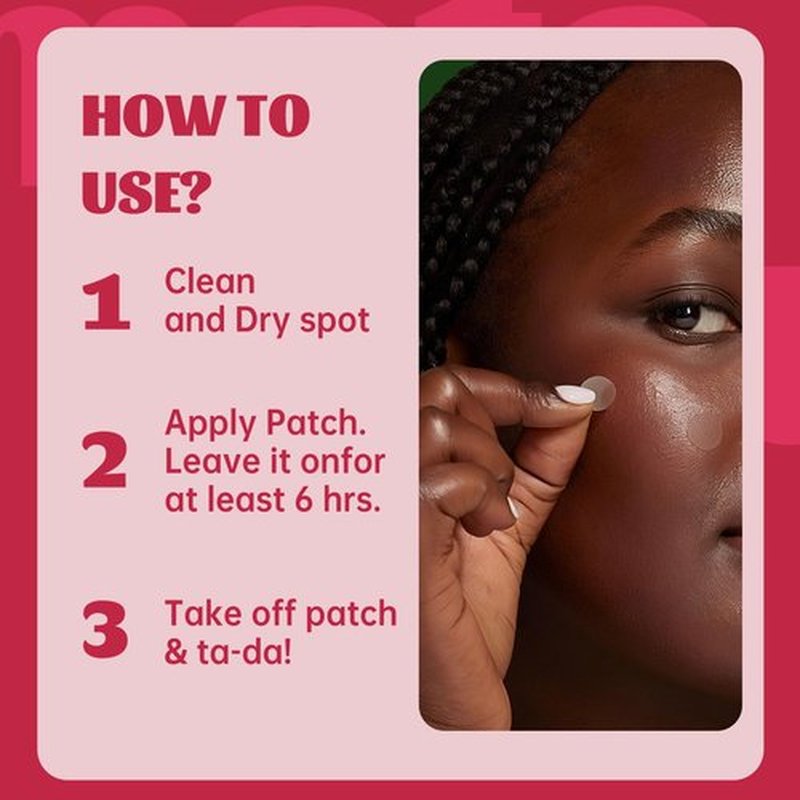 194pc Pimple Patches (192+2 Patches),3 Size with 2 Nose Hydrocolloid Acne Patches with Tea Tree Oil