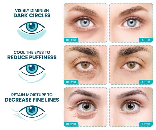 Stylia Collagen & Vitamin C Under Eye Patches - Hydrating, Firming Mask for Puffy Eyes & Dark Circles | 30 Pairs, Vegan