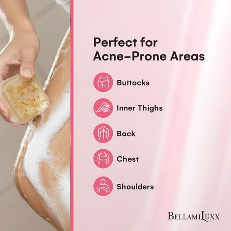 BellamiLuxx Body Acne Soap Bar: Antibacterial Bar for Butt, Thighs, Back, Body Acne, Folliculitis & Fungal Prone Skin - Tea Tree Oil, Sulfur & Salicylic Acid Soap - Reduce Bumps, Clogged Pores