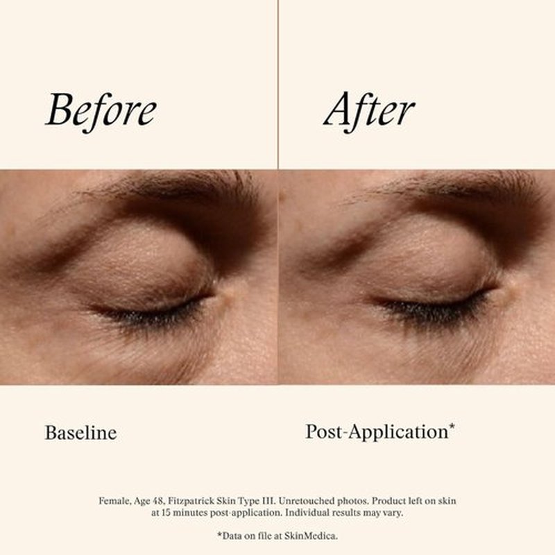SkinMedica Instant Bright Eye Cream - Age-Defying Formula for Dark Circles, Puffiness & Lines