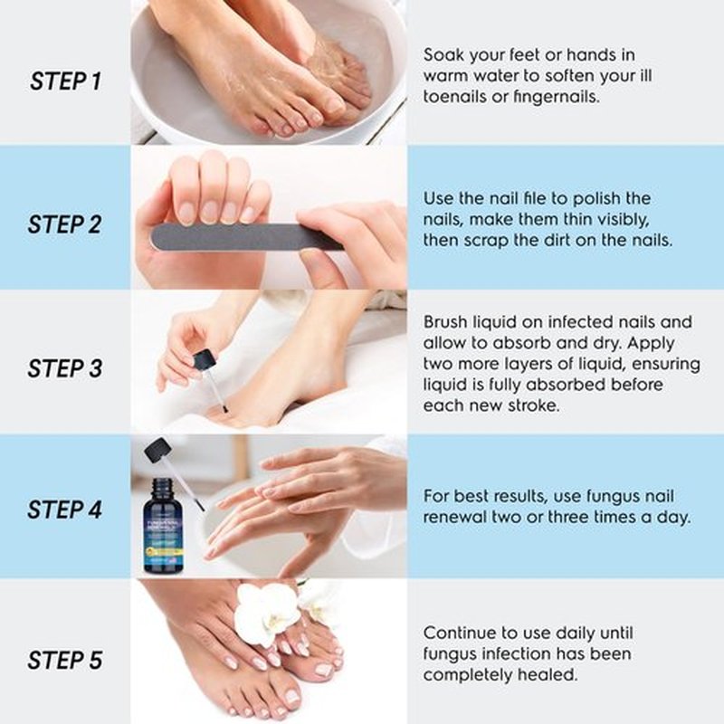 OSIMOON Toenail Fungus Treatment Extra Strength: Nail Fungus Treatment with 10% Undecylenic Acid, Nail Repair for Damaged Nails, Nail Fungus Treatment for Men and Women (2 Packs), Blue