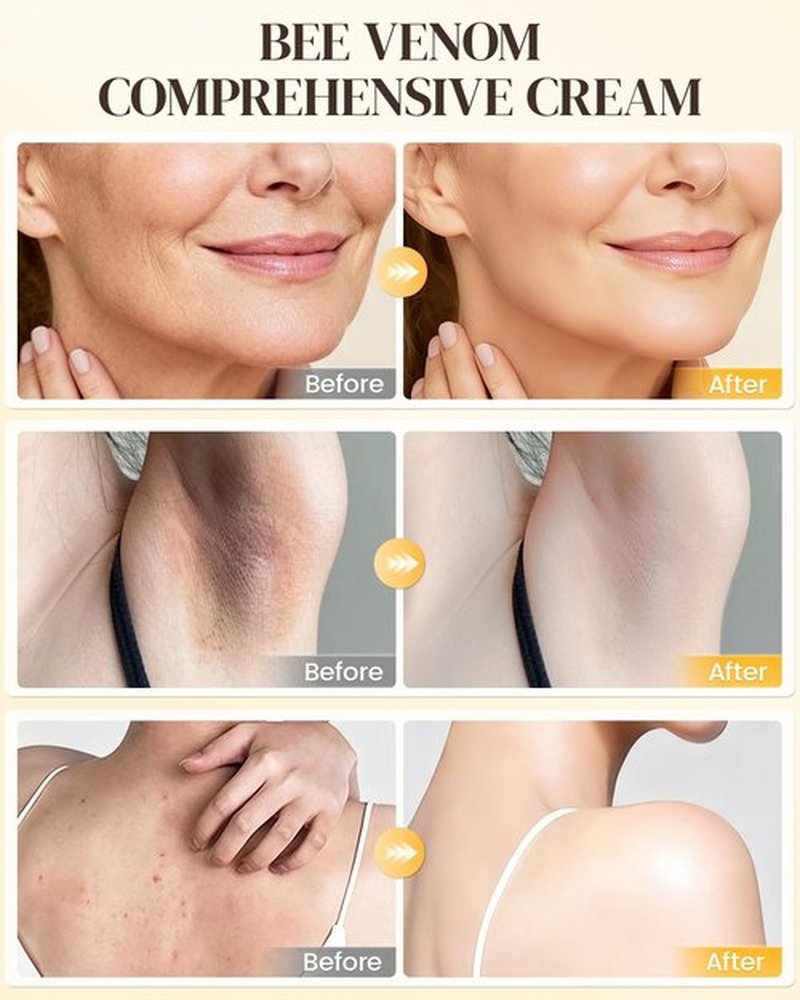 GAJUANR Bee Venom Moisturizing Cream, All-in-One Nourishing Moisturizer with Hyaluronic Acid, Firming & Hydrating Face and Body Cream, Natural Gentle Formula for All Skin Types (50g * 2PCS)