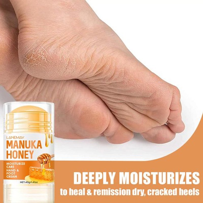 Grospe Honey Foot Balm Stick,Manuka Honey Stick Foot Cream for Dry Cracked Heels and Feet Moisturizing & Exfoliating Care for Dry Cracked Feet Knees and Hands Callus 1.41 Oz