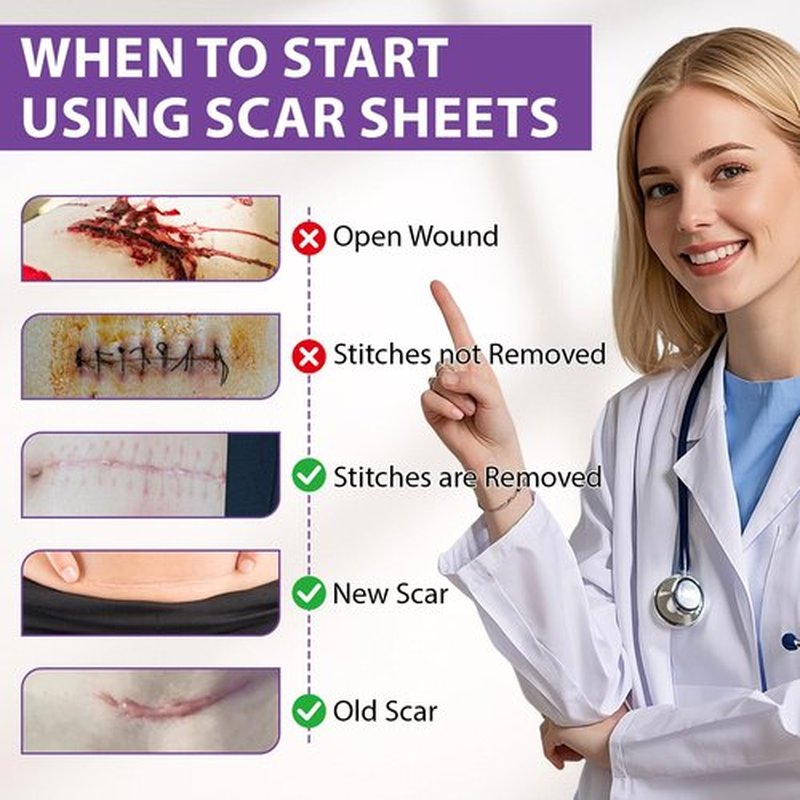 Silicone Scar Sheets, Silicone Sheets for Scars, Silicone Scar Tape for Surgical Scars, Medical Grade Scar Tape for Acne Scar Treatment, Stretch Marks, Tummy Tuck (1.6”x 60”), Roll-1.5M