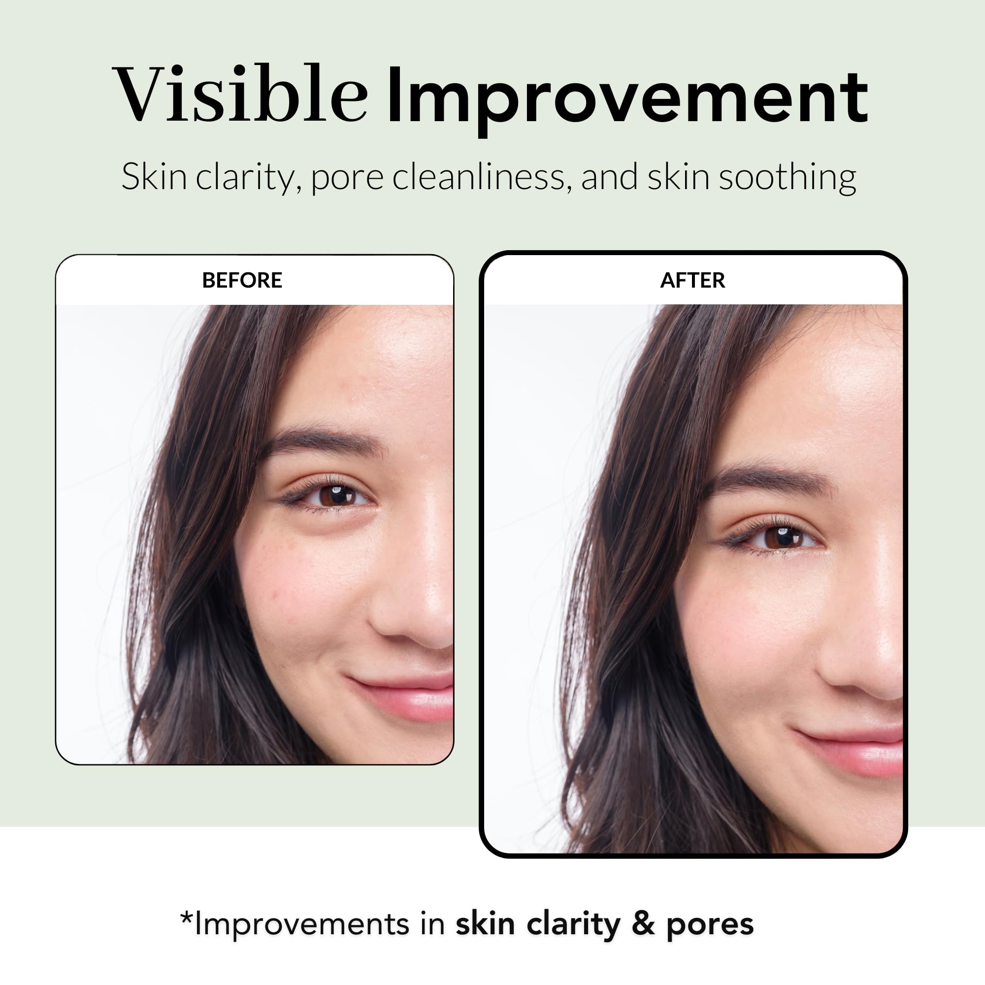 NOWATER Tea Tree Peel Off Mask for Acne-Prone Skin – Korean Wrapping Mask with Centella & 6 Tropical Fruit Extracts, Sebum Control Calming Face Mask, (2.4 fl.oz)