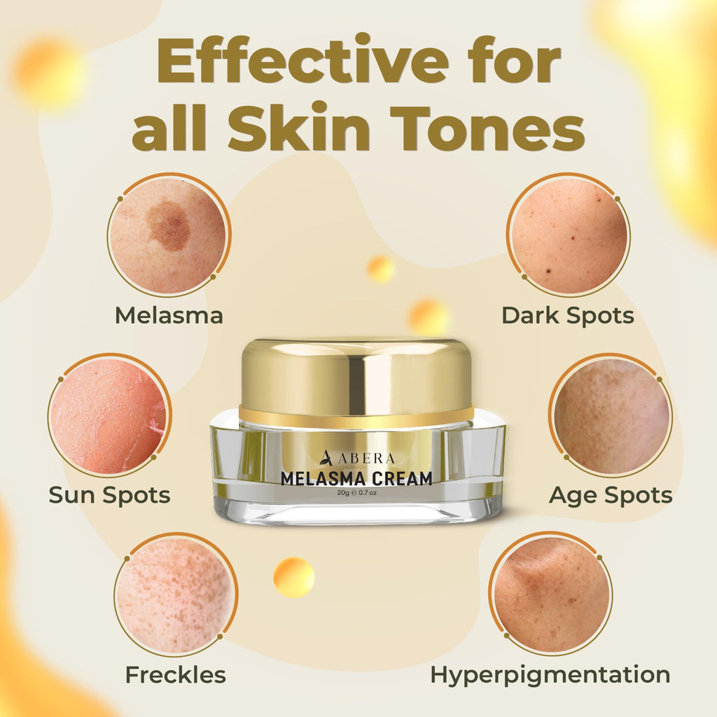 ABERA Melasma Cream, Dark Spot Corrector - Melasma, Freckle, Sun Spot, Age Spot Remover Advanced Formula for Women and Men (3 Boxes)