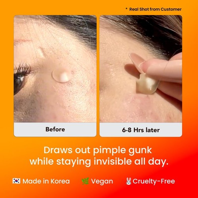 AVARELLE Acne Cover Patch Guardian – Invisible UPF 50+ Daytime Sun Guard Hydrocolloid Pimple Patches with Cica, Tea Tree & Calendula, Smart Acne Patch for Acne-Prone Skin, 40 Count