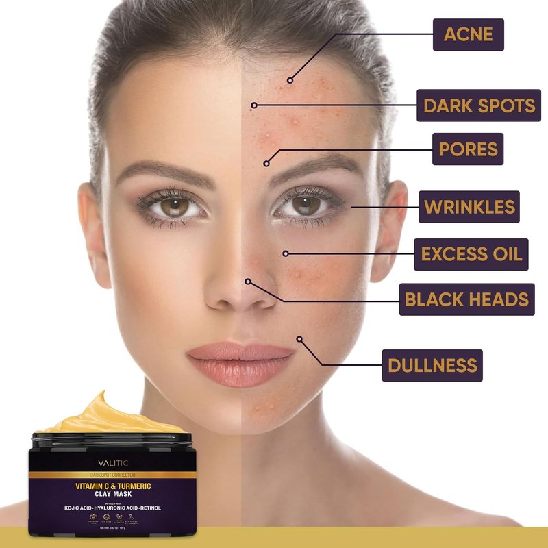 VALITIC Vitamin C & Turmeric Clay Mask - Dark Spot Corrector with Kojic Acid & Retinol - 100g Skin Care Solution