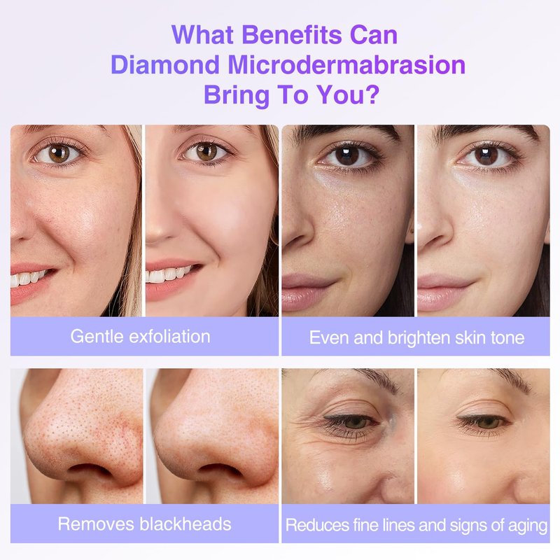UNOISETION Diamond Microdermabrasion Tips Replacement for Diamond Tip Microdermabrasion Machine, 9PCs Facial Peel Diamond Microderm Tips for Microdermabrasion Device