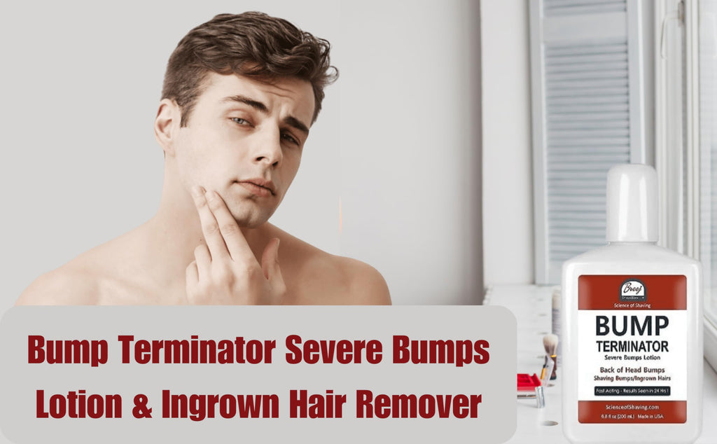 BREEJ BUMP TERMINATOR Severe Bumps Treatment | Razor Bumps And Ingrown Hair Treatment | Razor Bump Treatment, 200 mL