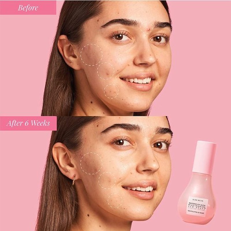 Glow Recipe Watermelon Niacinamide Dew Drops - Hydrating Face Serum & Primer | Travel Size 15ml