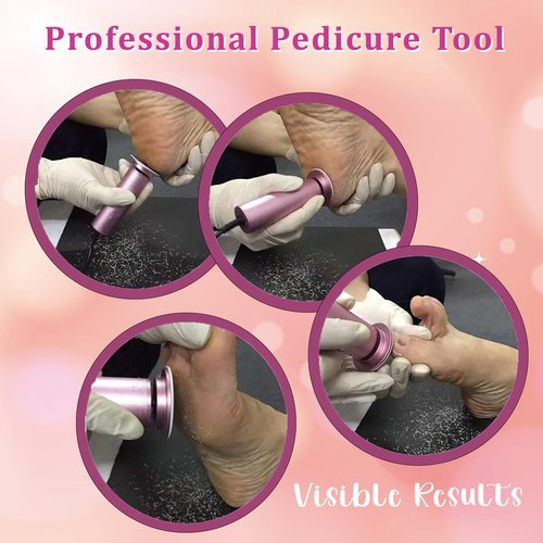 Dermave Upgraded Electric Callus Remover for Feet,Electric Foot File Foot Sander,Adjustable Speed Foot Scrubber,Women Men Dead Skin and Cracked Professional Pedicure Tool,60Pcs Sandpaper Discs