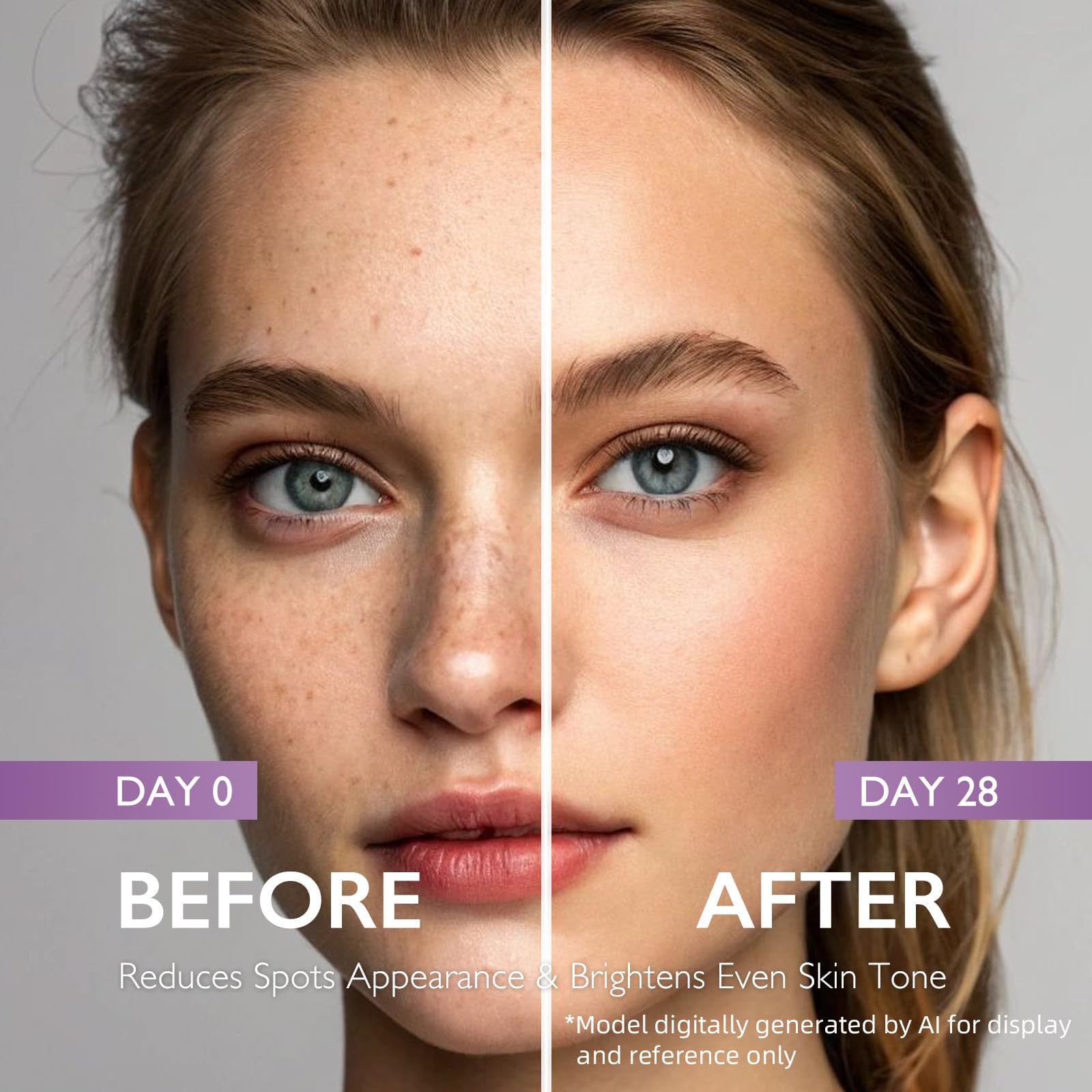 Dark Spot Corrector Serum with Retinol, Niacinamide & Alpha Arbutin, Brightening Face Serum for Uneven Tone, Post Acne Marks & Dull Skin, Hydrating Glow Formula with Hyaluronic Acid