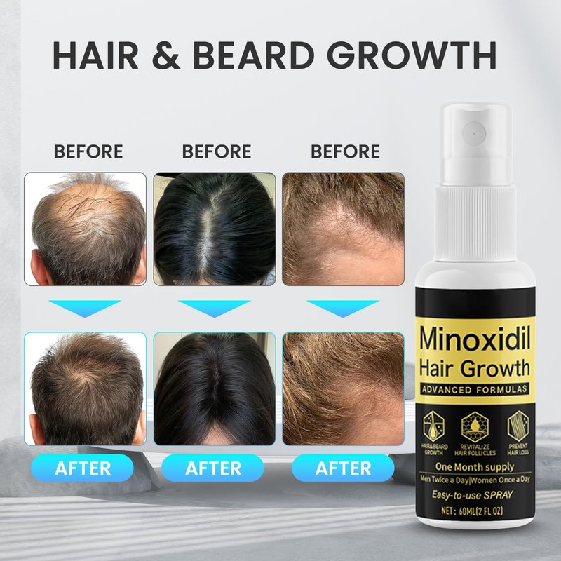 Xinweini Minoxidil for Men Beard Growth Kit, Minoxidil for Women Hair Growth Kit, Hair Loss Treatments for Women Hair Regrowth Treatment, Minoxidil 5%,3 pack