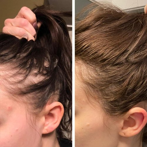Aceite de Romero para Crecimiento y Tratamiento Capilar, Gotero para Estimular el Crecimiento del Cabello y Prevenir la Caída, 60ML/2.2 Fl Oz (2 Unidades)