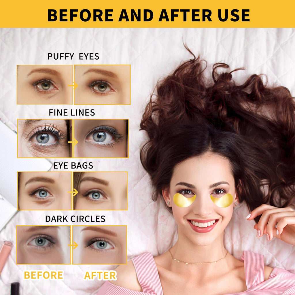 Under Eye Masks for Dark Circles and Puffiness 70PCS, Under Eye Patches for Puffy Eyes Treatment, Under Eye Gel Pads w/ Seaweed, Aloe Vera, Peptides for Eye Bags Treatment, Eye Mask Patches Skincare