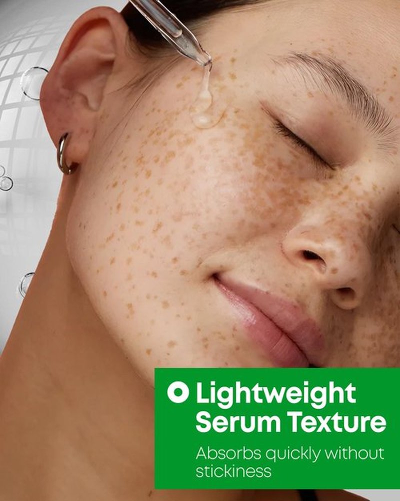 Nineless 10% Azelaic Acid Serum with Niacinamide & Snail Mucin - Redness Relief & Dark Spot Corrector for Face - Facial Serum for Acne-Prone, Oil Control & Pore Care 1.01 fl.oz
