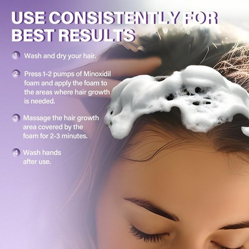 5% Minoxidil Foam for Women Hair Growth Foam Suitable for Hair Thinning Receding Hairline and Hair Loss to Hair Regrowth Get Thicker Fuller Hair