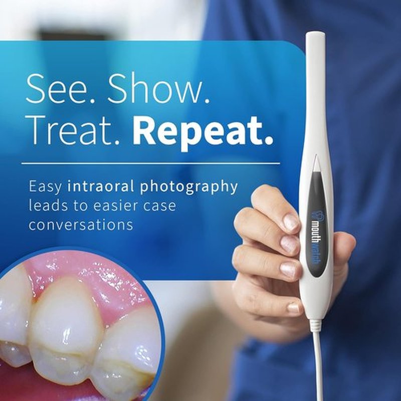 Intraoral Camera - Crystal Clear Images | Easy Single Button Operation, Lightweight & Ergonomic Design