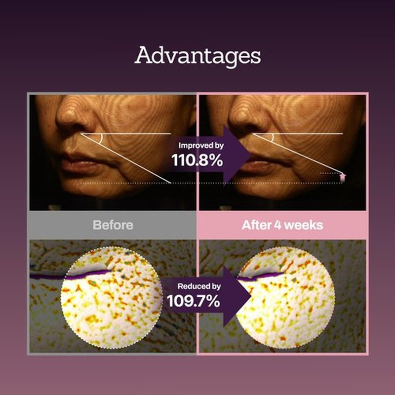 Collagen Peptide 12X Boosting Serum, Enhances Skin Elasticity & Reduces Deep Wrinkles, Promotes Collagen Production for Firm and Youthful Skin, Korean Skincare, 1.01 fl.oz