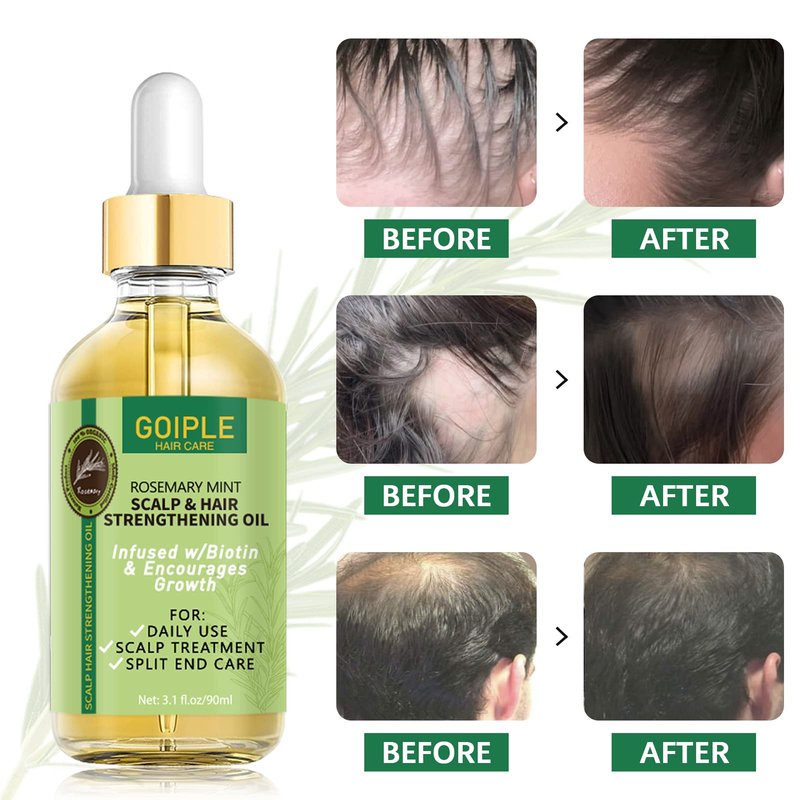 WOZUTUNT Rosemary Oil for Hair Growth, 3.1 FL OZ, Pure Natural Scalp Oil with Essential Oils, Nourishing Treatment for Split Ends, Dry Scalp