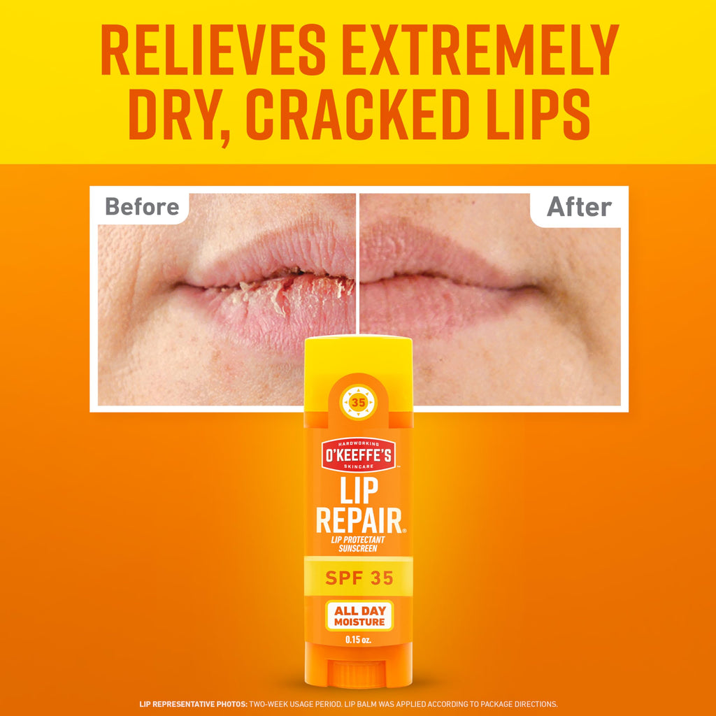 O'Keeffe's Lip Repair SPF 35 Lip Balm - Stick (3 Pack) - Sun-Safe Moisturizer for Extremely Cracked, Dry Lips